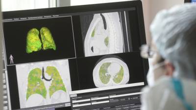 Ханс Клюге - Осенью увеличится число смертей от коронавируса - vesti.ru