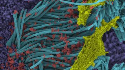 Учёные показали поразительные снимки клеток, заражённых SARS-CoV-2 - vesti.ru - штат Северная Каролина