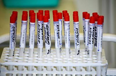 В России за сутки выявили 5 670 случаев заражения коронавирусом - pnp.ru - Россия