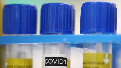 В Колумбии число случаев коронавируса превысило 784 тысячи - russian.rt.com - Колумбия