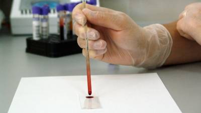 Стандартный анализ крови определяет риск смерти от COVID-19 - vesti.ru