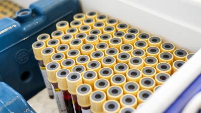 Число случаев коронавируса в Бразилии достигло 4 745 464 - russian.rt.com - Бразилия - Рио-Де-Жанейро