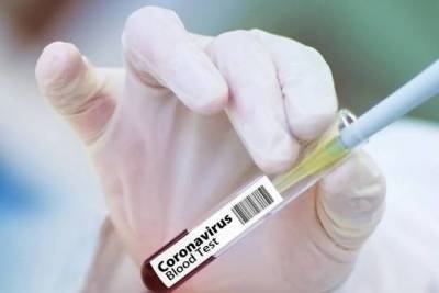 Вильям Гейтс - Фонд Гейтса заключил соглашение с 16 компаниями для производства вакцин от COVID-19 - versia.ru