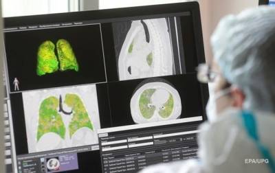 Медики опровергли необратимость последствий COVID-19 - korrespondent.net - Австрия