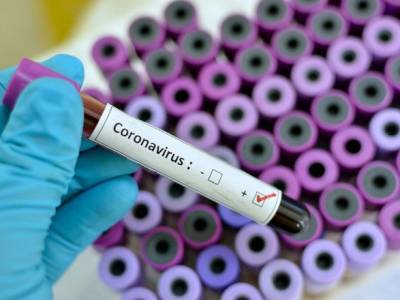 Коронавирус грозит сексуальному здоровью: почему COVID-19 вызывает импотенцию - unn.com.ua - Киев