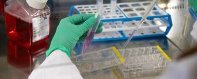 Николай Крючков - Иммунолог Крючков назвал факторы риска повторного заражения COVID-19 - runews24.ru