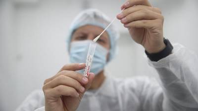 Росздравнадзор зарегистрировал единую тест-систему на COVID-19 и грипп - iz.ru - Россия - Израиль