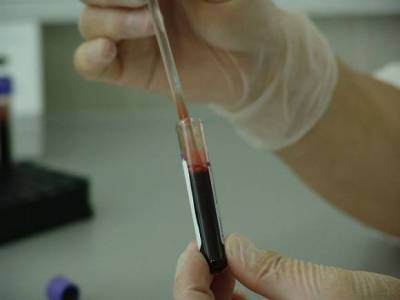 Новое исследование: ученые узнали, носители какой группы крови живут дольше - rosbalt.ru