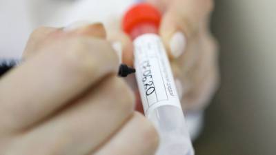 Илона Маска - Российские медики выявили 24 715 новых случаев коронавируса за сутки - nation-news.ru - Россия