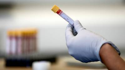 В Дании выявили южноафриканский штамм коронавируса - russian.rt.com - Дания - Юар