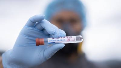 Российские медики выявили 21 734 новых случая коронавируса за сутки - nation-news.ru - Россия