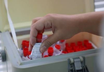 Украинские ученые разработали тест для оценки поствакцинального иммунитета к COVID-19 - facenews.ua - Украина