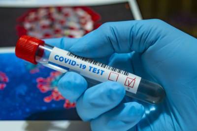 В Украине за минувшие сутки обнаружили 4383 новых случая коронавируса, выздоровел – 14 501 лица - zik.ua - Украина