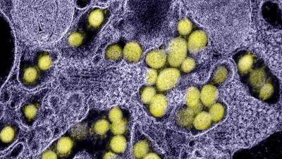 Ученые разработали прибор для оценки заразности штаммов коронавируса - iz.ru - Канада - Израиль - Колумбия