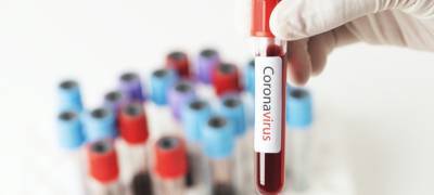 "Клиники на Чайкиной": вы можете узнать, есть ли у вас коронавирус, всего за 30 минут - stolicaonego.ru