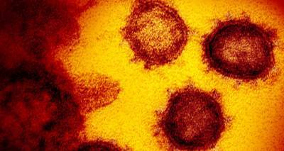 Ученые создали прибор-определитель заразности штаммов коронавируса - ru.armeniasputnik.am - Армения