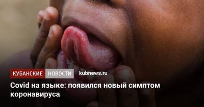 Covid на языке: появился новый симптом коронавируса - kubnews.ru - Англия
