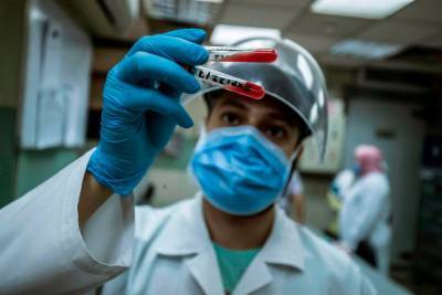 В Египте начали вакцинацию против коронавируса - 24tv.ua - Китай - Египет