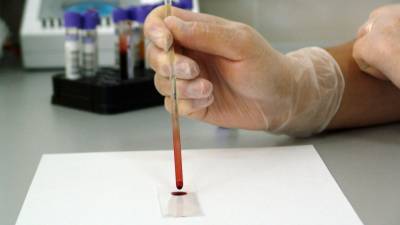 Инженеры «научили» искусственный интеллект делать анализы крови за минуту - inforeactor.ru