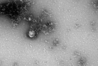 Учёные Роспотребнадзора впервые сфотографировали британский штамм коронавируса - online47.ru
