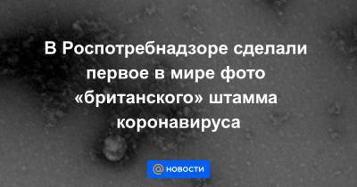В Роспотребнадзоре сделали первое в мире фото «британского» штамма коронавируса - news.mail.ru