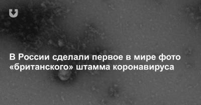 В России сделали первое в мире фото «британского» штамма коронавируса - news.tut.by - Россия