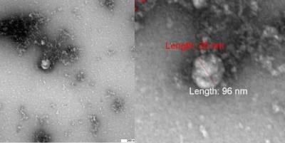 Ученые «Вектора» показали фото «британского» штамма коронавируса - polit.ru - Англия - Лондон