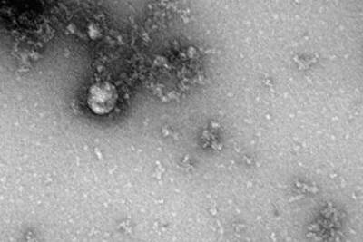 Роспотребнадзор показал первое изображение нового штамма коронавируса - lenta.ru