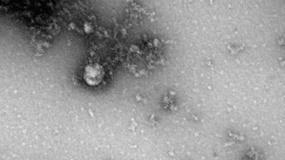 Российские ученые первыми в мире сфотографировали британский штамм коронавируса - newdaynews.ru - Новосибирск