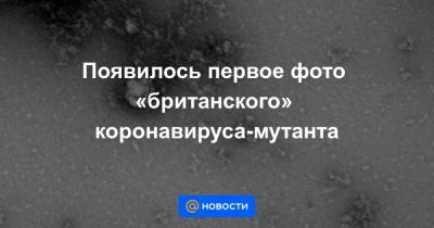 Появилось первое фото «британского» коронавируса-мутанта - news.mail.ru - Англия