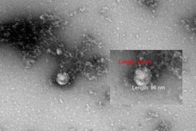 Новосибирские ученые первыми в мире сфотографировали британский штамм коронавируса - tayga.info - Новосибирск