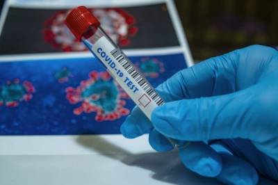 За сутки в России выявили 19 290 заразившихся коронавирусом - aif.ru - Россия