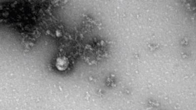 Российские учёные сделали первую в мире фотографию британского штамма коронавируса - russian.rt.com