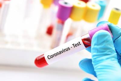В США появился автомат по продаже тестов на коронавирус и мира - cursorinfo.co.il - Сша - Китай