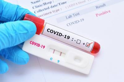 В Украине фиксируют увеличение заболеваемости COVID-19, за сутки - 5 529 новых случаев - zik.ua - Украина - Киев