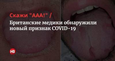 Скажи «ААА!» Британские медики обнаружили новый признак COVID-19 - nv.ua - Англия