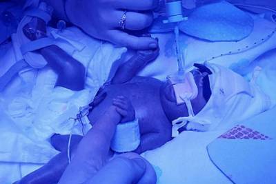 Младенец переболел сепсисом, COVID-19 и кишечной палочкой и выжил вопреки всему - lenta.ru - Англия