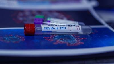Российские врачи зафиксировали 24 150 новых случаев коронавируса в стране - inforeactor.ru