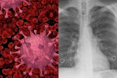 Найден механизм естественной защиты от коронавируса - mk.ru