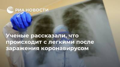 Ученые рассказали, что происходит с легкими после заражения коронавирусом - ria.ru - Москва - Бостон