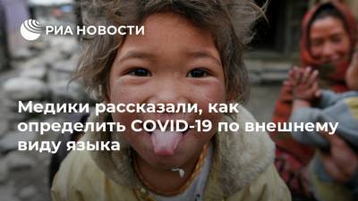 Медики рассказали, как определить COVID-19 по внешнему виду языка - ria.ru - Москва - Англия