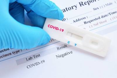 Максим Степанов - В Украине за минувшие сутки обнаружили 4158 новых случаев коронавируса COVID-19 - zik.ua - Украина