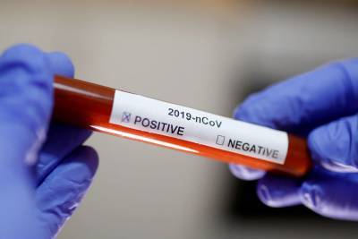 Россия - В Ленобласти выявили 216 новых зараженных коронавирусом 5 января - ivbg.ru - Ленобласть обл.