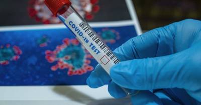 В Турции изобрели 10-секундный тест на коронавирус - rus.delfi.lv - Турция - Латвия