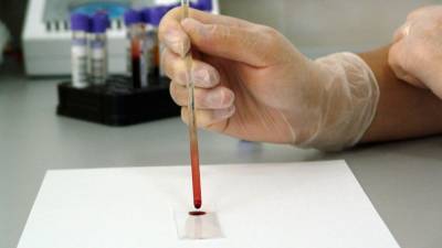 Ученые назвали группу крови с самым сильным иммунитетом к вирусам - nation-news.ru