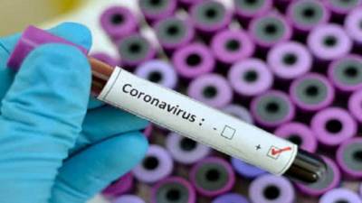 В ВСУ за сутки зарегистрировали 44 случая коронавируса - hubs.ua - Украина