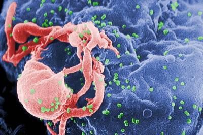 Ученые из США обнаружили способ побороть ВИЧ и мира - cursorinfo.co.il - Сша