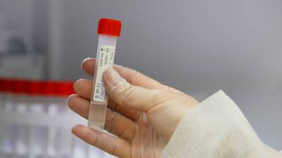 В России за сутки проведено более 580 тысяч тестов на коронавирус - russian.rt.com - Россия