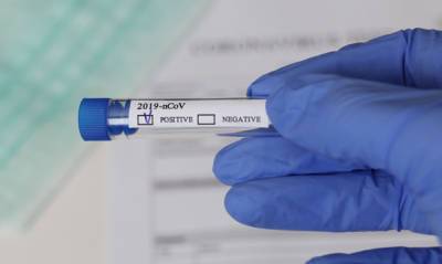 Татьяна Голикова - Роспотребнадзор предложил сократить срок выполнения ПЦР-теста на COVID-19 до 24 часов - og.ru