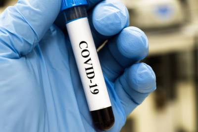 COVID-19 мог появиться как мутация коронавирусов - gubdaily.ru - Ухань